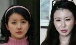 整容在线观看神马,揭秘整容在线观看的惊心动魄之旅